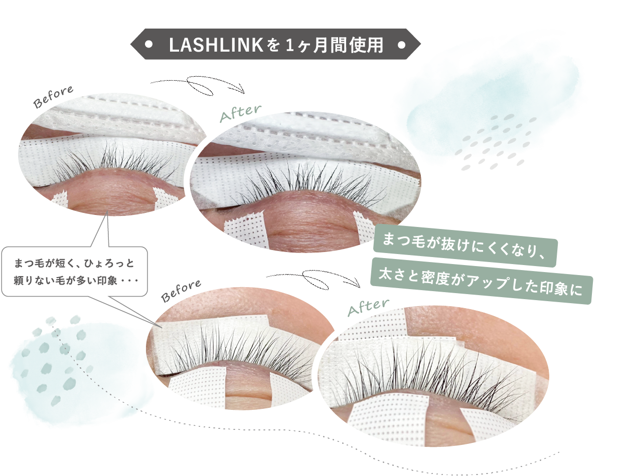 キャンペーン LASHLINK(ラッシュリンク) アイラッシュセラム 6ml (5+1
