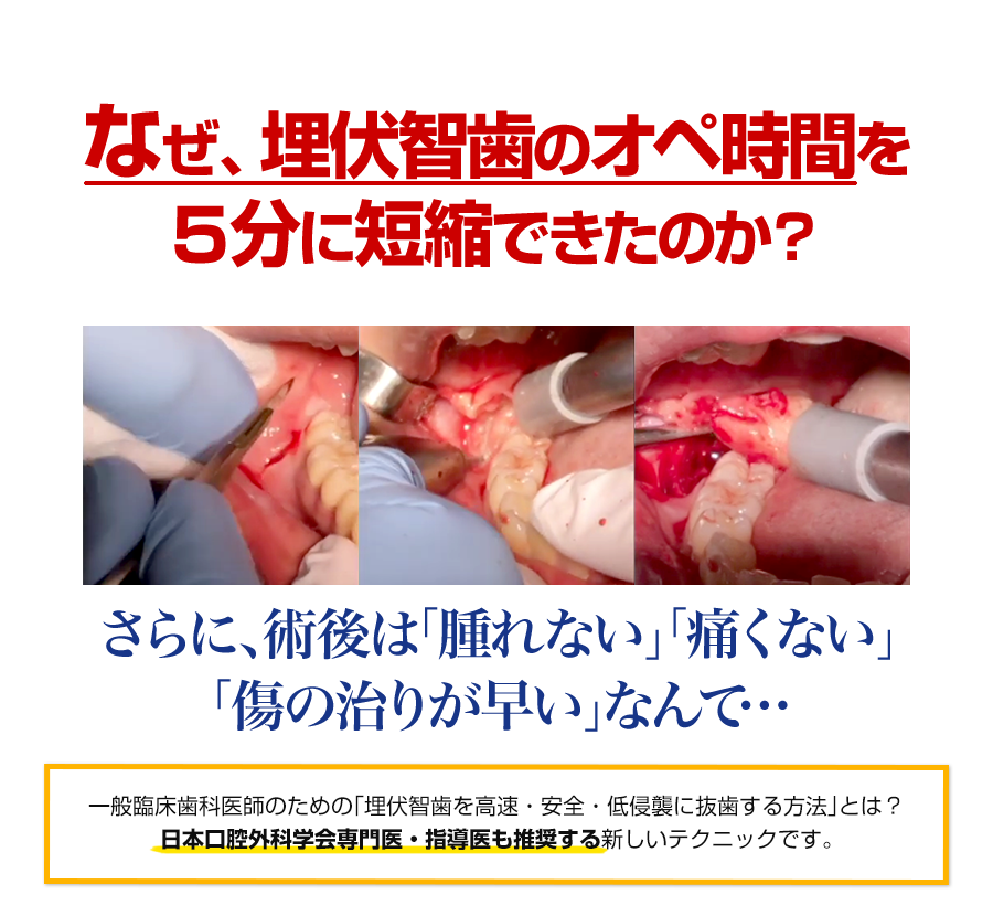 株式会社 医療情報研究所 | 超高速無痛抜歯～たった5分で埋伏智歯抜歯