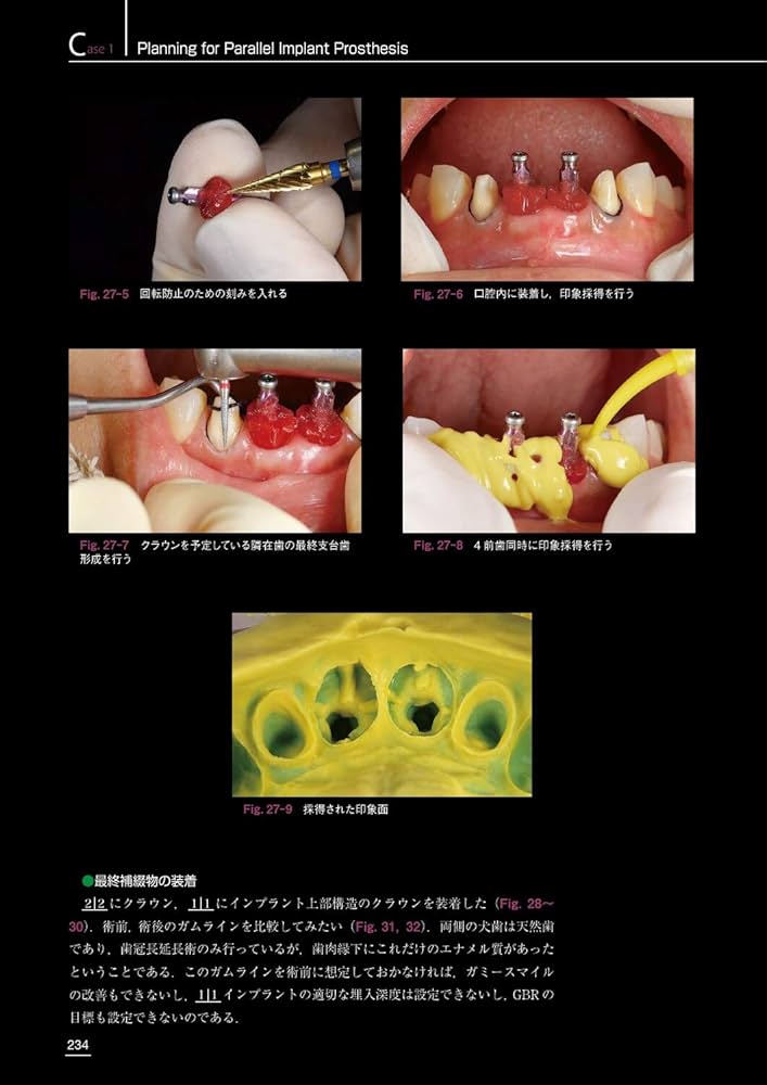 Amazon.co.jp: 包括的治療戦略 Vol.2 for Functional Management