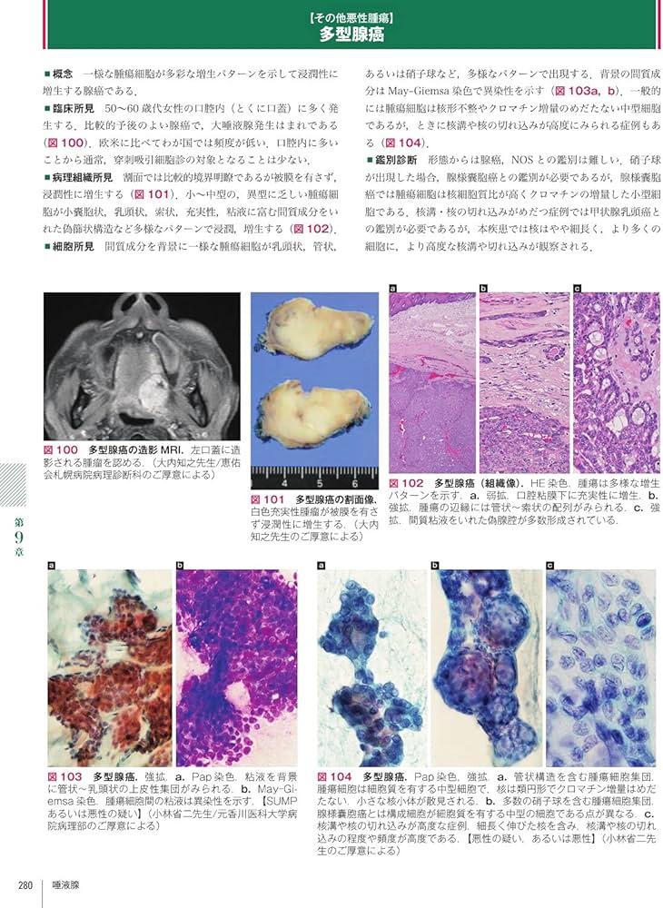 Amazon.co.jp: 細胞診鑑別アトラス : 金城 満: 本