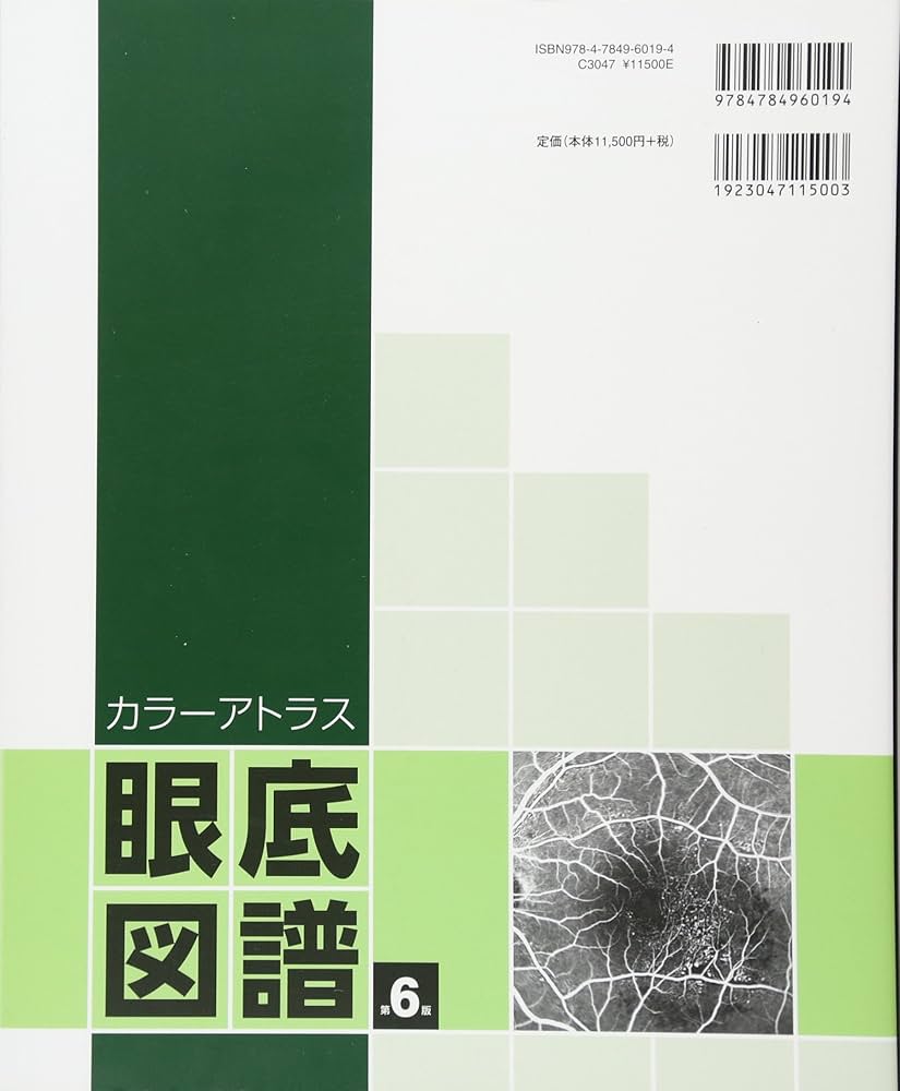 カラーアトラス 眼底図譜 | 湯澤美都子, 川村昭之 |本 | 通販 | Amazon